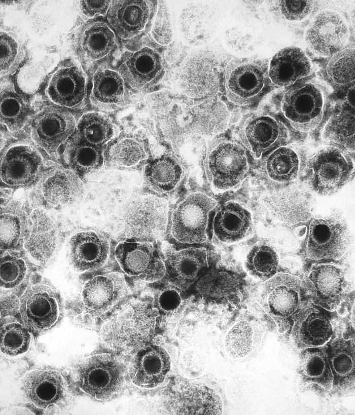 Micrografia eletrônica do vírus herpes simples