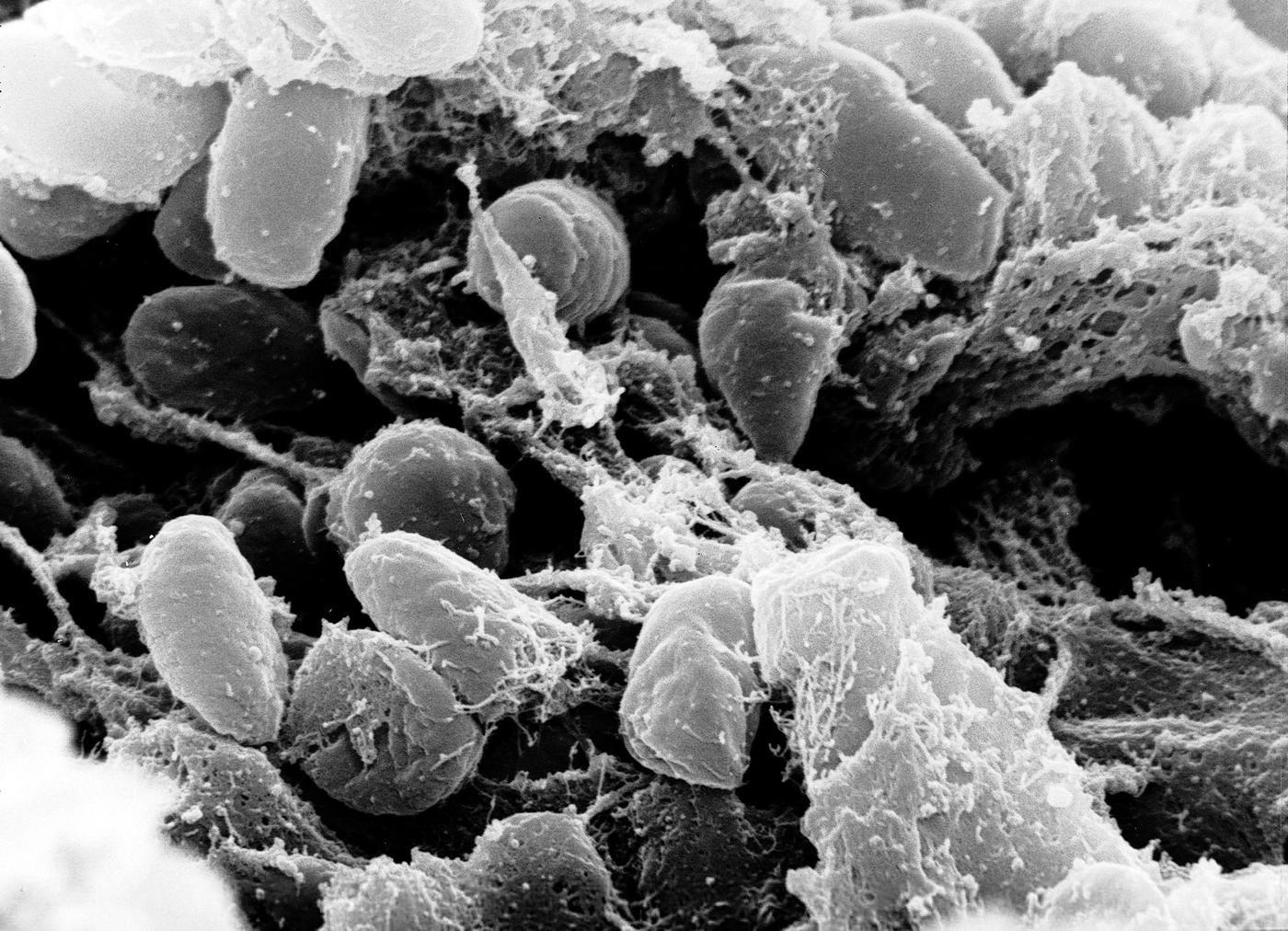 Bactérias Yersinia pestis vistas ao microscópio eletrônico, em preto e branco