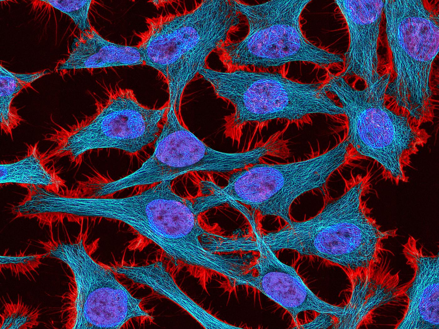 Células HeLa vistas em fluorescência